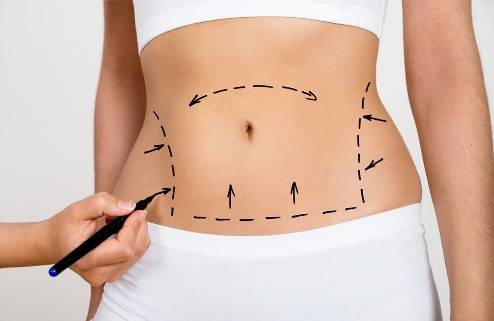 abdominoplastie-tunisie